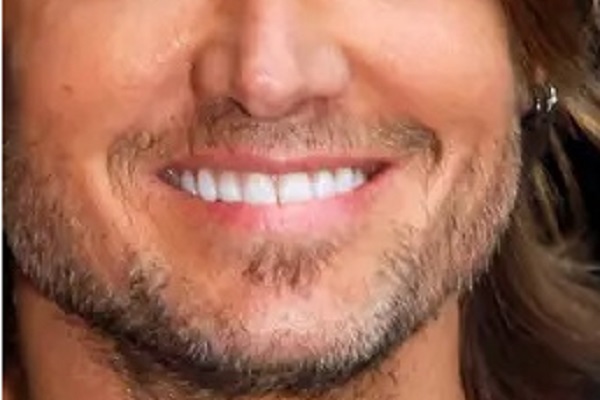 15----hollywood-smile