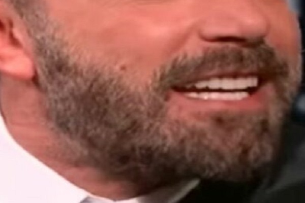 16----hollywood-smile