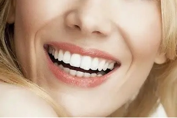 2----hollywood-smile