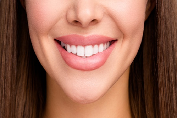 3----hollywood-smile