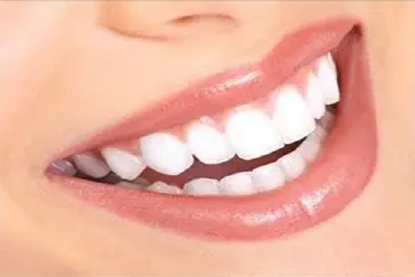 7----hollywood-smile