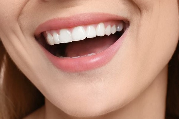 8----hollywood-smile